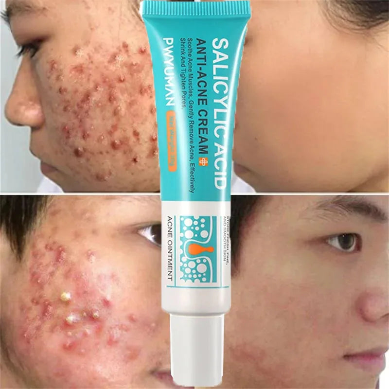 Clear Skin Rescue Cream
