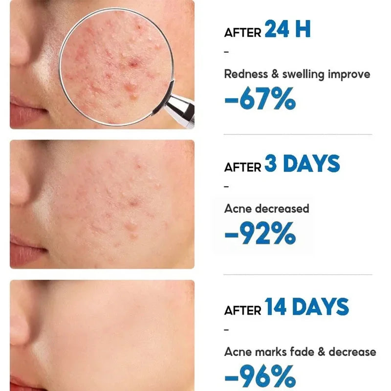 Clear Skin Rescue Cream