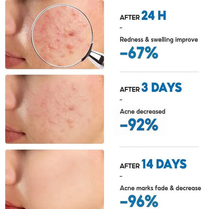 Clear Skin Rescue Cream