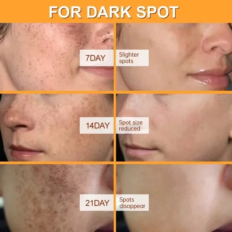 Radiant Glow Skin Lightener