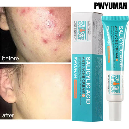 Clear Skin Rescue Cream