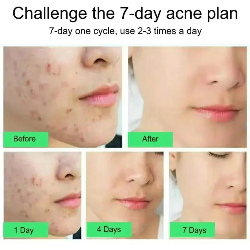 Clear Skin Rescue Cream