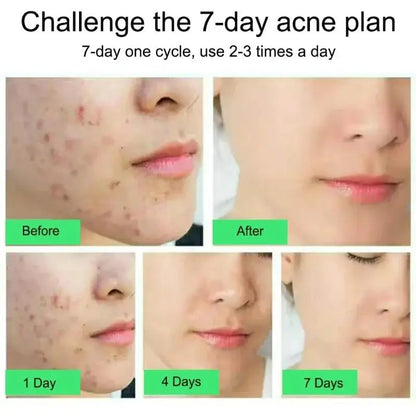 Clear Skin Rescue Cream