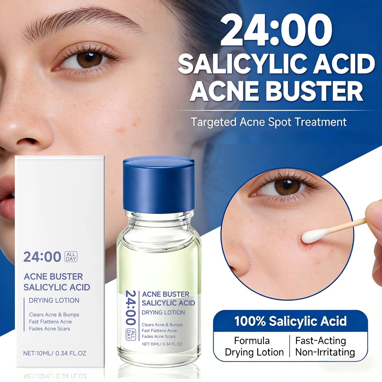 Salicylic Acid Drying Lotion Face Serum with Cotton Swab– Reduce Pimples &amp; Breakouts Fade Acne Scars Minimize Pores Skin Renewal