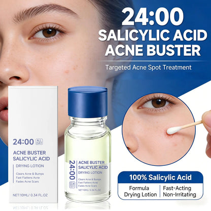 Salicylic Acid Drying Lotion Face Serum with Cotton Swab– Reduce Pimples &amp; Breakouts Fade Acne Scars Minimize Pores Skin Renewal