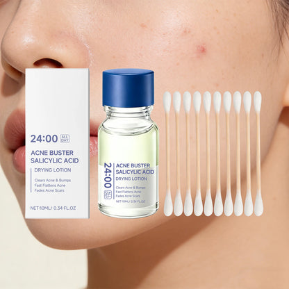 Salicylic Acid Drying Lotion Face Serum with Cotton Swab– Reduce Pimples &amp; Breakouts Fade Acne Scars Minimize Pores Skin Renewal
